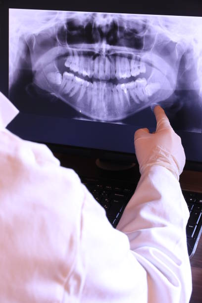Emergency Dentist for Dental Implants
