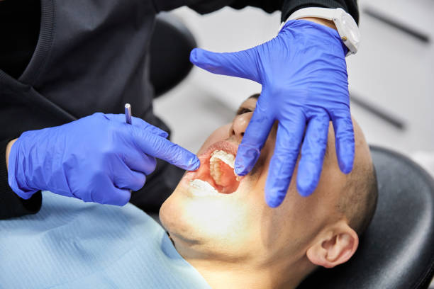 Best Emergency Dentist for Knocked-Out Tooth in Poulsbo, WA